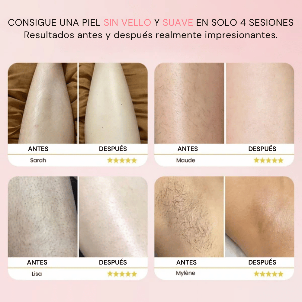 Ephra Cosmetics • Depiladora IPL de Luz Pulsada