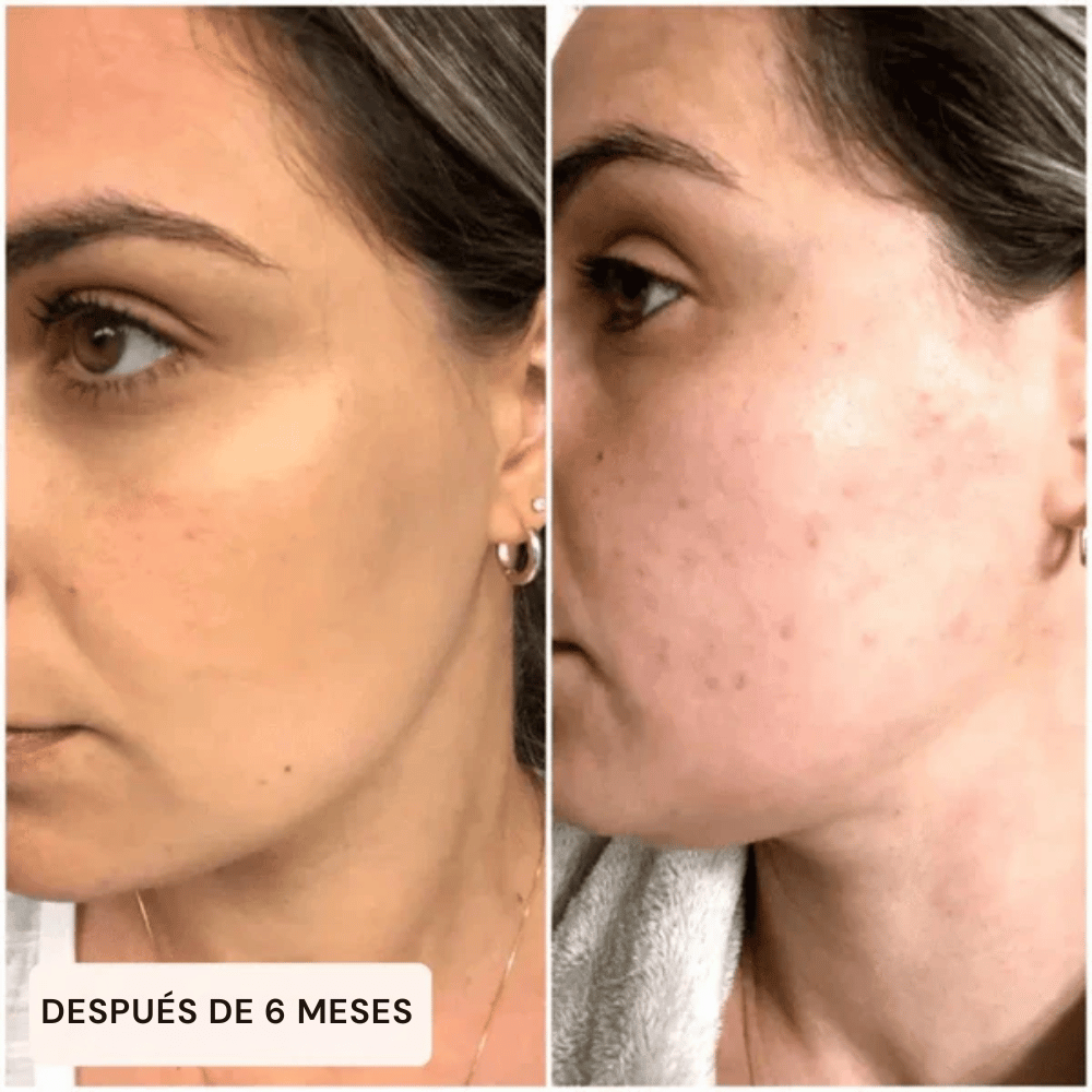 Guante exfoliante para cuerpo y rostro