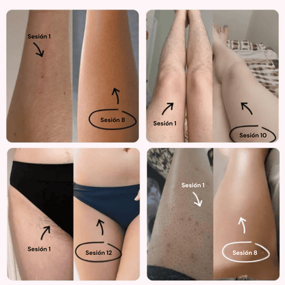 Ephra Cosmetics • Depiladora IPL de Luz Pulsada