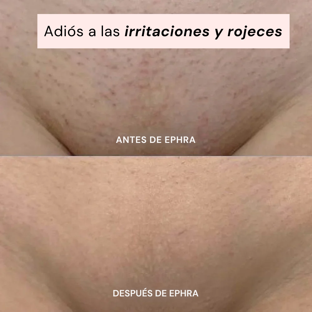 Ephra Cosmetics • Afeitadora eléctrica íntima 2-en-1