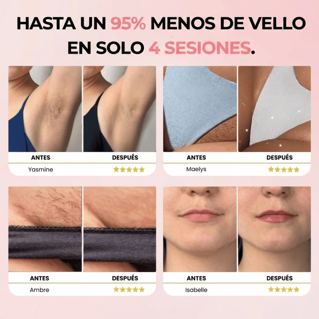 Ephra Cosmetics • Depiladora IPL de Luz Pulsada