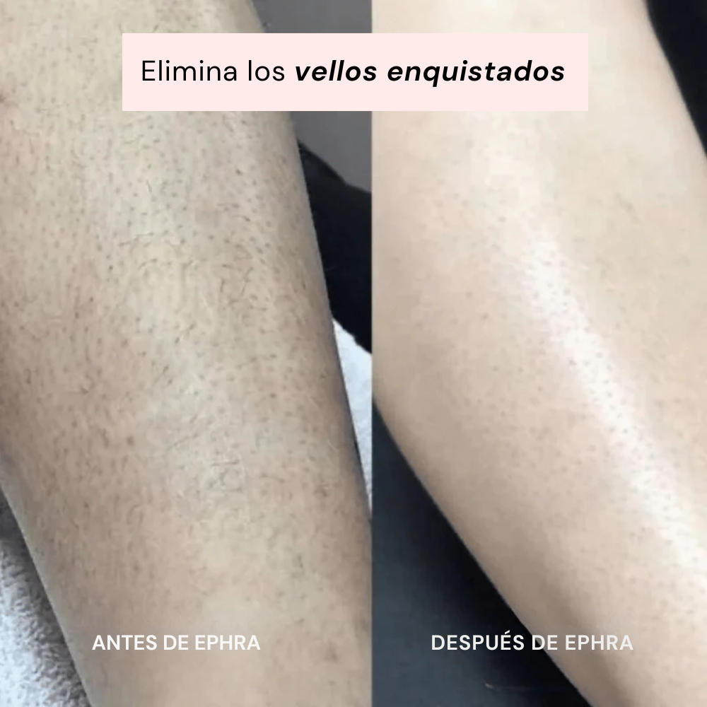 Ephra Cosmetics • Afeitadora eléctrica íntima 2-en-1
