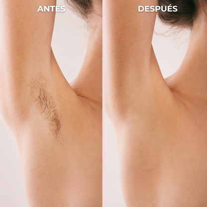 Bikini-Trimmer para mujeres